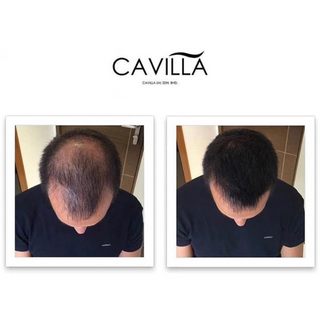 Cavilla Hair Tonic